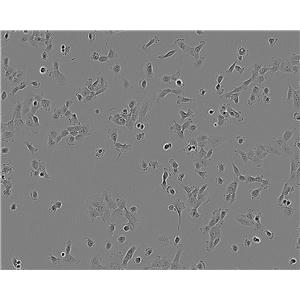 Ishikawa细胞：人子宫内膜癌细胞系,Ishikawa