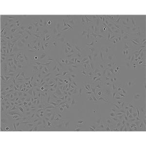 HLF-a细胞：人肺细胞系