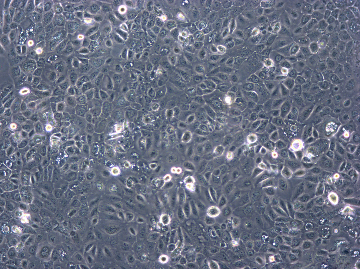 KP4细胞：人胰腺癌细胞系,KP4