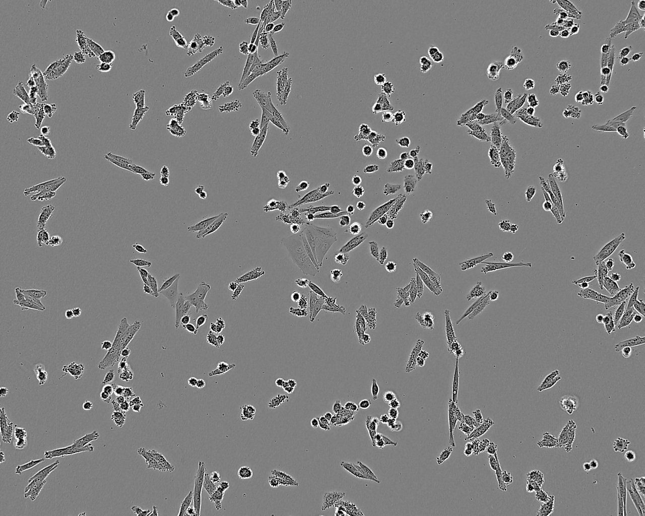 A101D细胞：人黑色素瘤细胞系,A101D