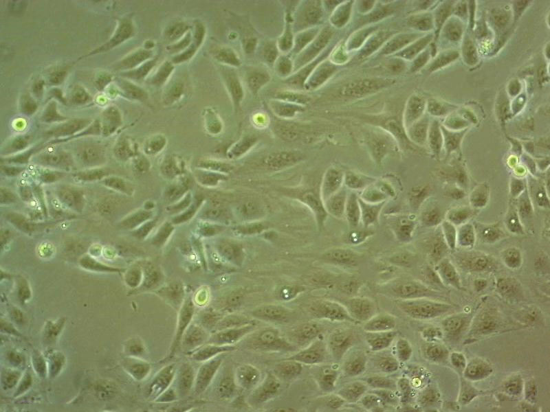 NUGC-3细胞：人胃癌细胞系,NUGC-3