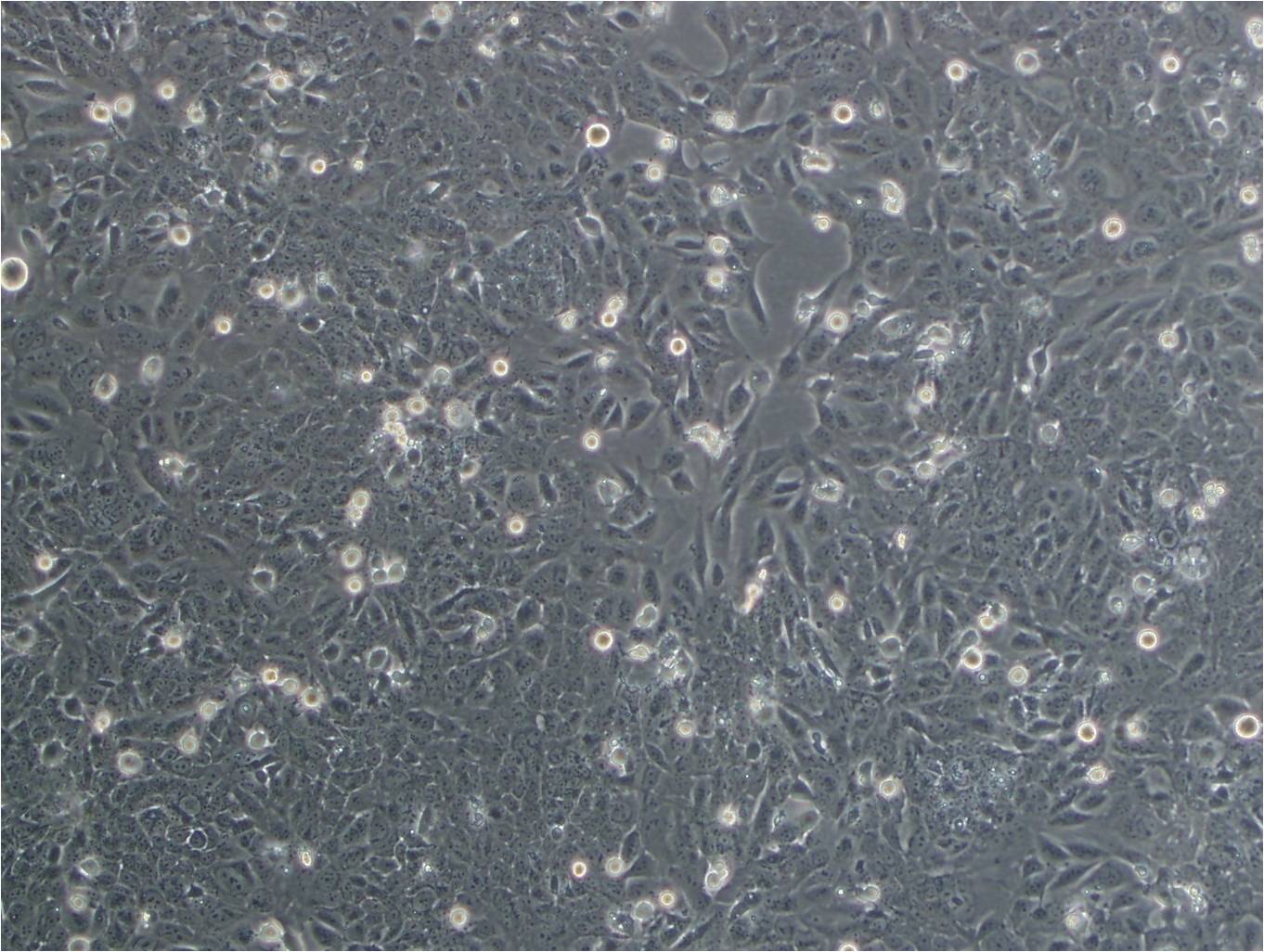 Caov-3细胞：人卵巢癌细胞系,Caov-3