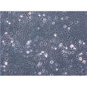 COV504细胞：人卵巢癌细胞系