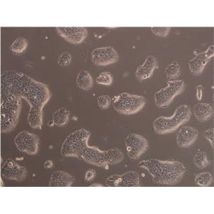 MeWo细胞：人恶性黑色素瘤细胞系