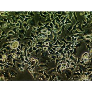 HT-1080细胞：人纤维肉瘤细胞系