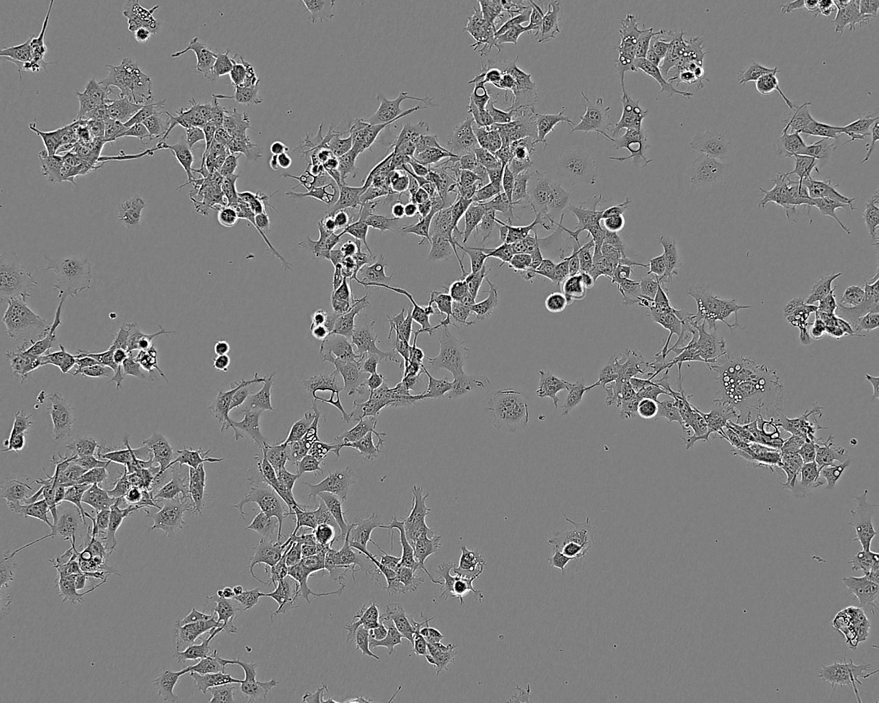 COR-L105细胞：人原发性非小细胞肺癌细胞系,COR-L105