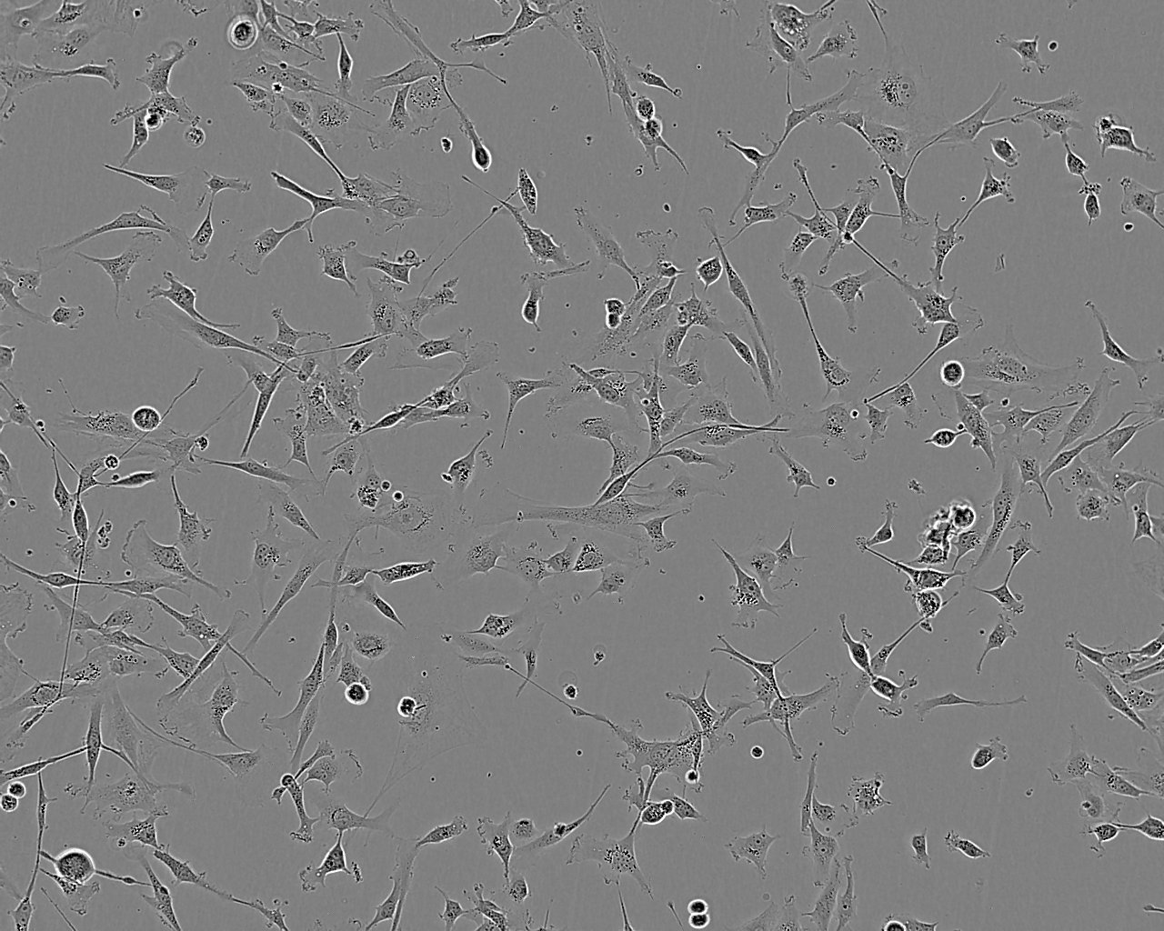 SV40 MES 13细胞：小鼠肾小球系膜细胞系,SV40 MES 13