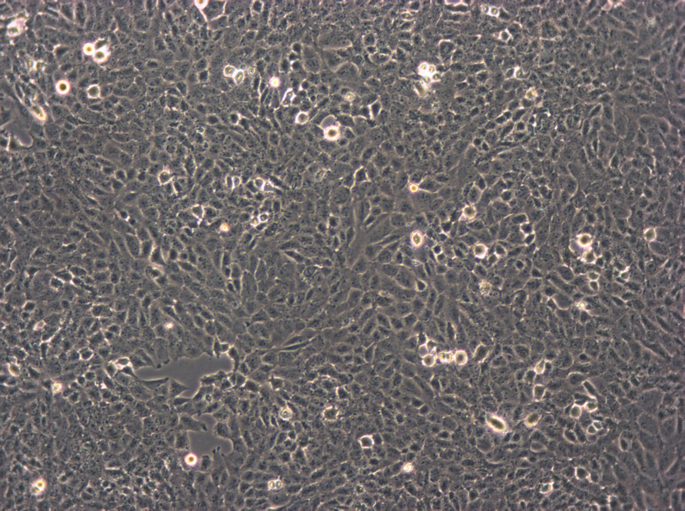 U2OS细胞：人骨肉瘤细胞系,U2OS