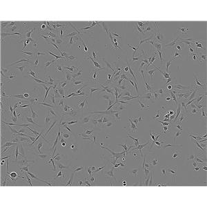 SV40 MES 13细胞：小鼠肾小球系膜细胞系,SV40 MES 13