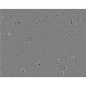 DH82细胞：狗肾恶性组织细胞增生症细胞系