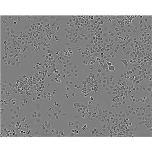 hTERT-RPE1细胞：人视网膜色素上皮细胞系