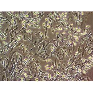 WI-38细胞：人胚肺成纤维细胞系