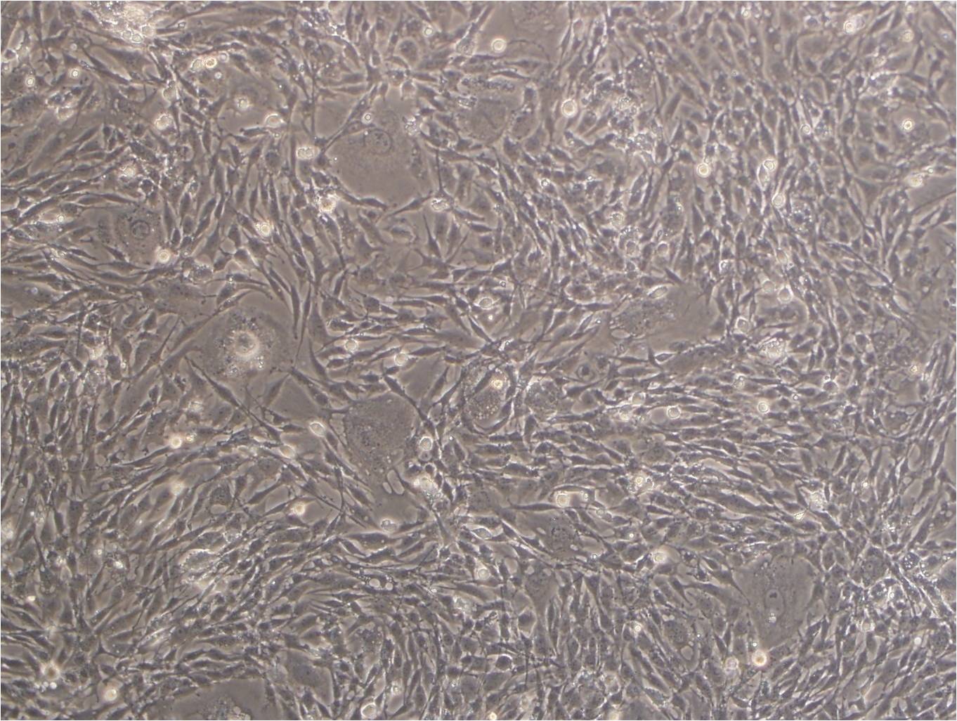 REC-1细胞：人淋巴瘤细胞系,REC-1