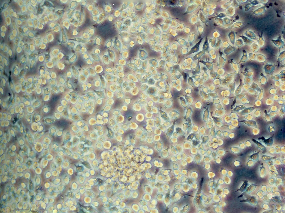 U266B1细胞：人外周淋巴细胞系,U266B1