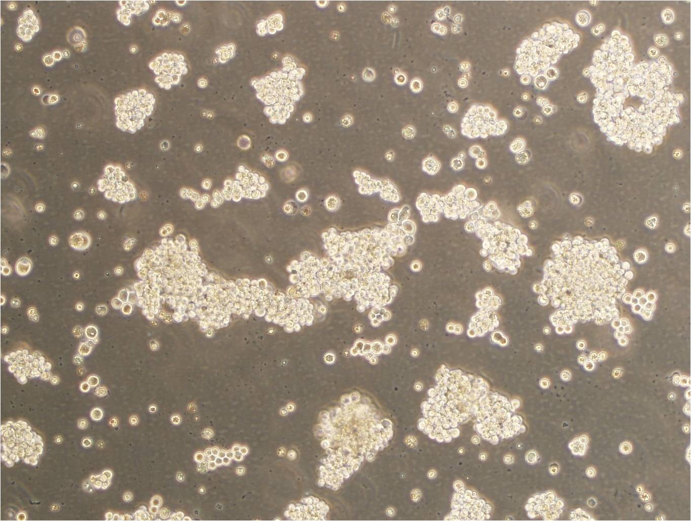 SU-DHL-4细胞：人弥漫性组织淋巴瘤细胞系,SU-DHL-4
