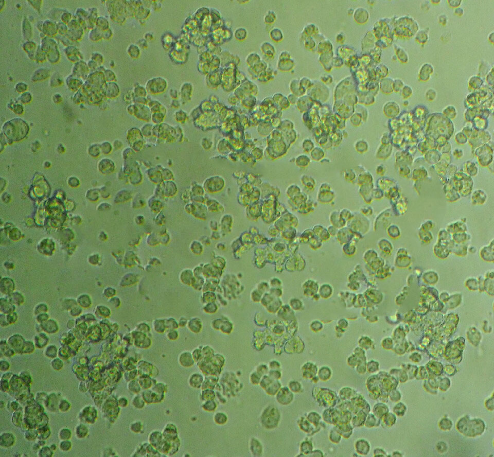 BV-173细胞：人外周血B细胞白血病细胞系,BV-173