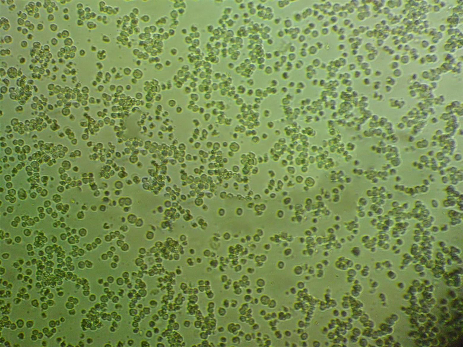 OCI-AML-2细胞：人急性髓系白血病细胞系,OCI-AML-2