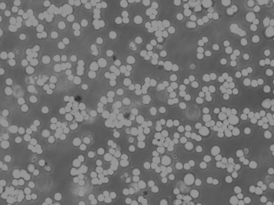 L-540细胞：人霍奇金淋巴瘤细胞系,L-540