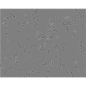 HL-60细胞：人原髓细胞白血病细胞系,HL-60