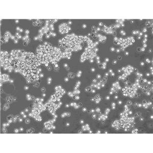 SUP-T1细胞：人淋巴母细胞淋巴瘤细胞系