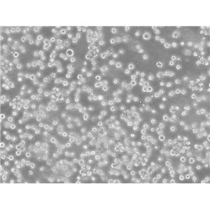 JVM-3细胞：人慢性髓白血病细胞系