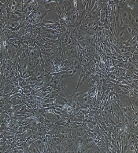 肾小球内皮细胞,Glomerular Endothelial Cells