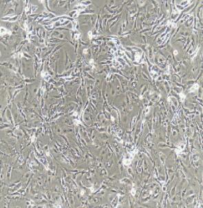 輸尿管上皮細(xì)胞,Ureteral Epithelial Cells