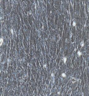 膀胱成纤维细胞,Bladder Fibroblasts Cells