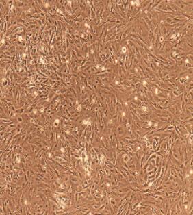 前列腺上皮细胞,Prostate Epithelial Cells