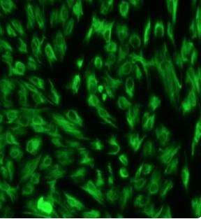 前列腺成纤维细胞,Prostate Fibroblasts Cells
