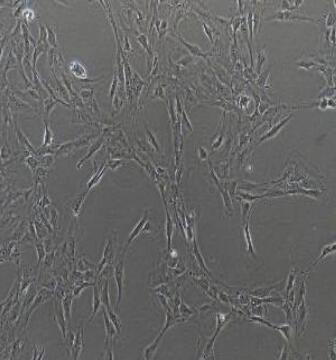 腎上腺皮質(zhì)細(xì)胞,Human Adrenal Cortical Cells