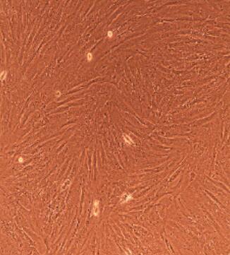 卵巢间质细胞,Thyroid Epithelial Cells