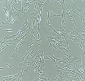 子宫平滑肌细胞,Uterine Smooth Muscle Cells