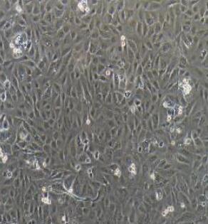 宫颈上皮细胞,Human cervical epithelial cells