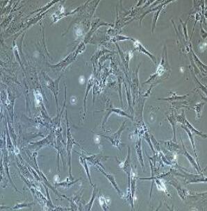 乳腺癌（腫瘤）細(xì)胞,Human Breast Tumor Cells