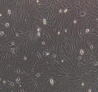 子宫内膜间质细胞,Human Uterine Stromal Cells