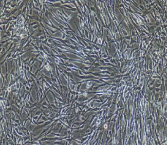 脂肪微血管内皮细胞,Adipose Microvascular Endothelial Cells