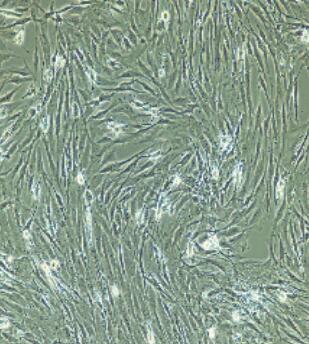 韌帶成纖維細胞,Ligament Fibroblasts Cells