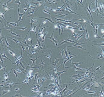 关节滑膜成纤维细胞,Synovial Fibroblasts Cells