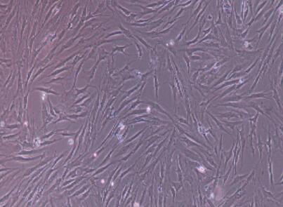 骨髓间充质干细胞,Bone Marrow Mesenchymal Stem Cells