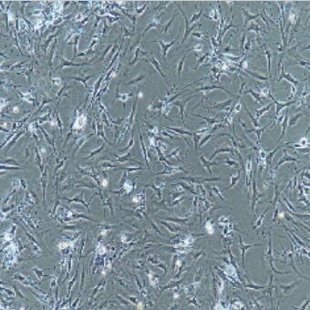 类风湿关节炎滑膜成纤维细胞,Human Rheumatoid Arthritis Synovial Fibroblasts Cells