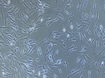 皮肤成纤维细胞,Dermal Fibroblasts Cells