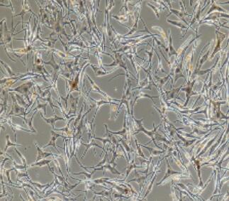 黑色素細(xì)胞,Human Skin Melanocytes Cells