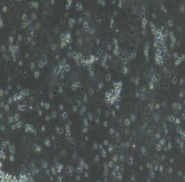 NK细胞,NK Cells