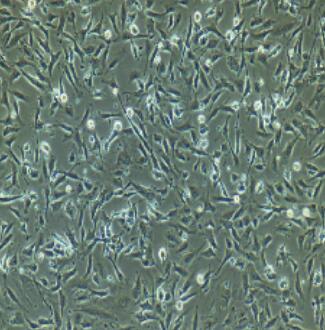 內(nèi)皮祖細(xì)胞,Endothelial Progenitor Cells