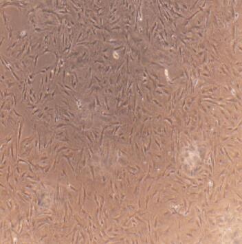 牙周膜干细胞,Periodontal Ligament Stem Cells