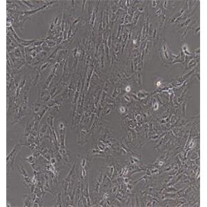 膀胱上皮细胞,Bladder Epithelial Cells