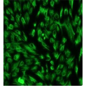 前列腺成纤维细胞,Prostate Fibroblasts Cells