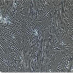 输卵管成纤维细胞,Human Fallopian Tube Fibroblasts Cells