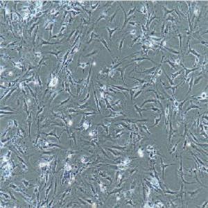 类风湿关节炎滑膜成纤维细胞,Human Rheumatoid Arthritis Synovial Fibroblasts Cells